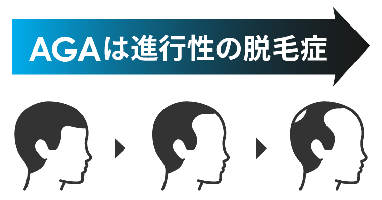 AGAは進行性の脱毛症
